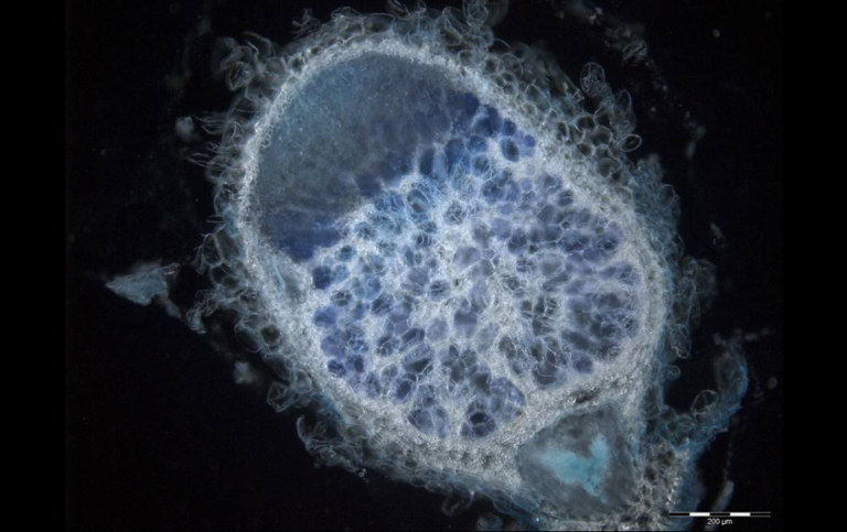 Medicago truncatula nodule