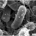 Infection of E.coli with novel phage SU10