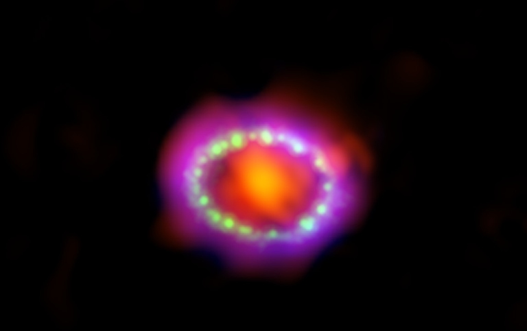 SN1987A