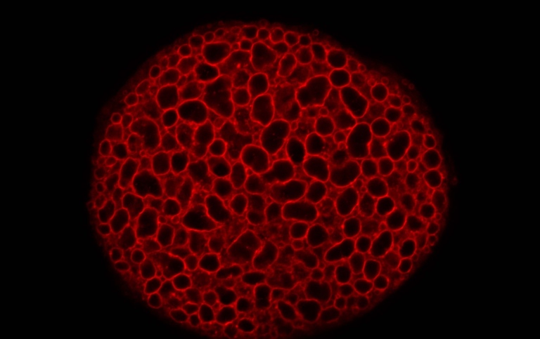 Drosophila salivary gland cells expressing a fluorescently-labelled protein
