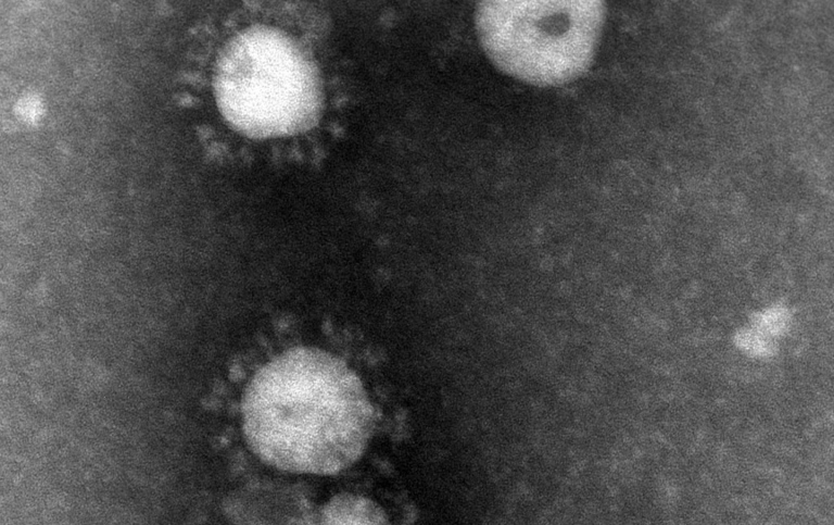 Coronavirus (sars). Bilden är tagen med elektronmikroskopi. Viruspartiklarna är negativt kontrastera