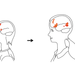 Pencil drawing of two young people with brain areas highlighted with color