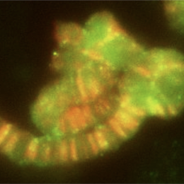 FISH experiment showing the distribution of a repetitive ncRNA in the polytene chromosomes of Drosophila melanogaster. The green signal is FISH. The red signal is a counterstaining with anti-H3K9ac.