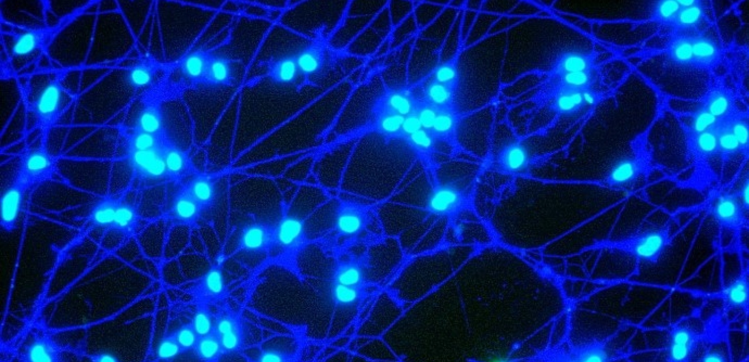 The complexity of the nervous system