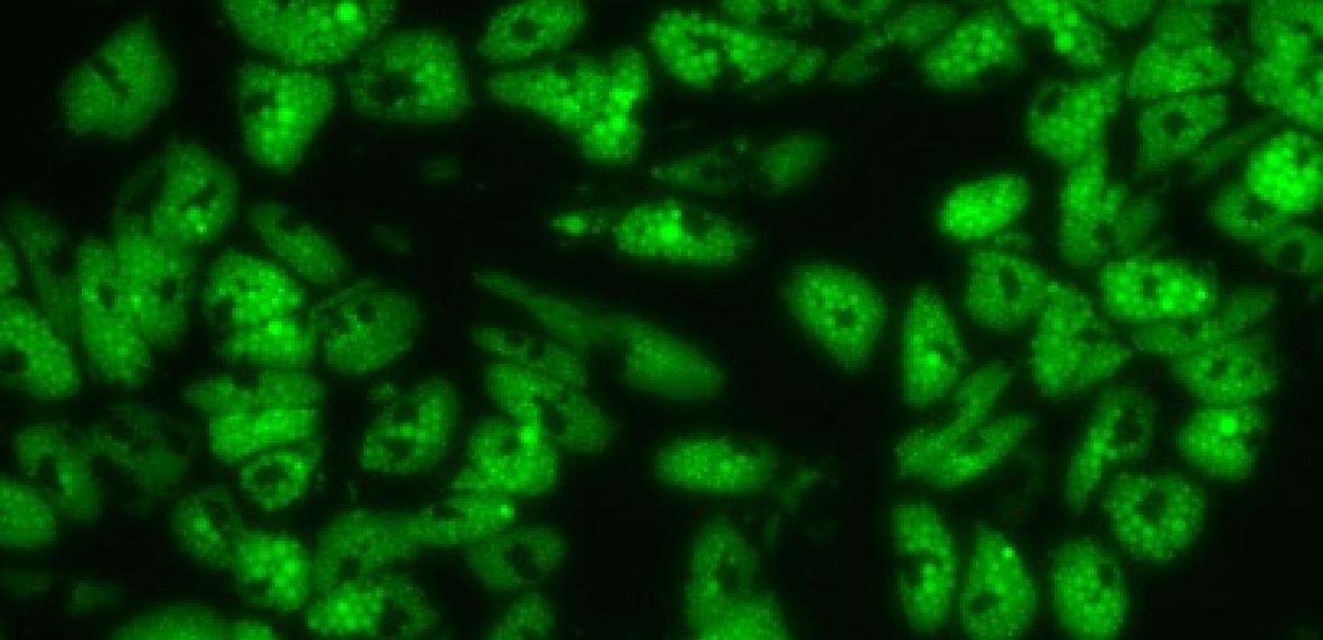 Fat cells in Vitro