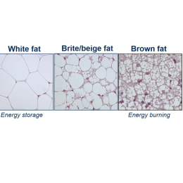 Different types of adipose tissue. Photo: Susanne Keipert