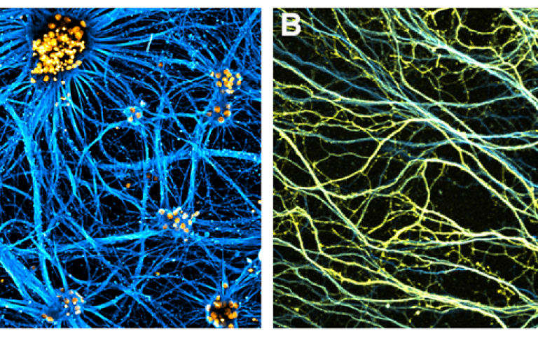 motor_neurons