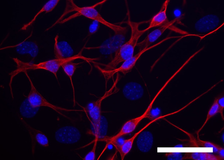 Neurochemistry – Neurotoxicology 
