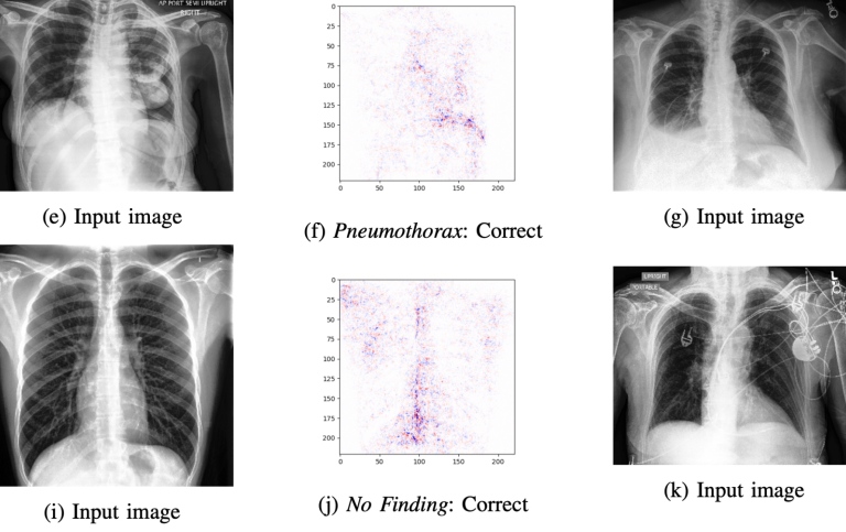 Chest X-rays and data from them, used to study interpretability.