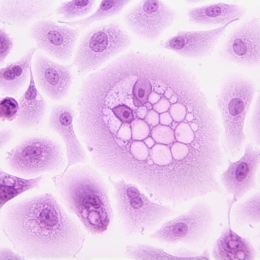 HPV-16 cells - a high-risk type for cancer.
