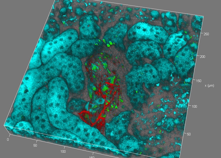 FITC mCherry Autofluorescence