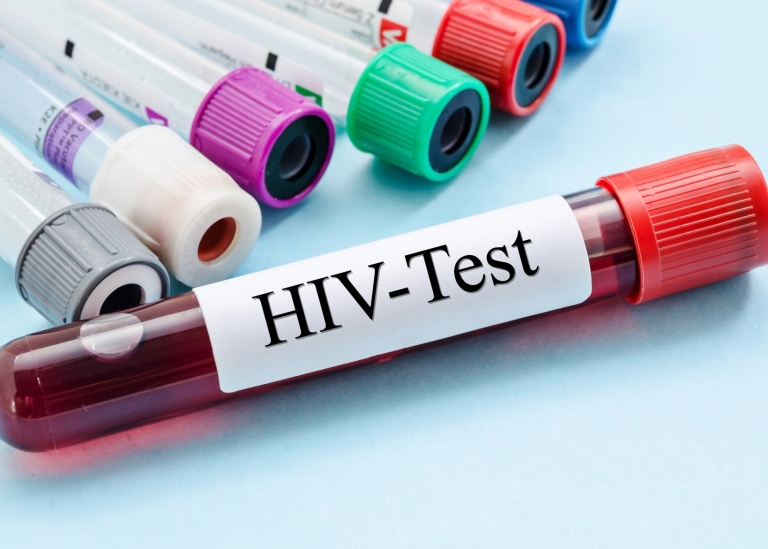 Ett litet provrör märkt med texten HIV-test.