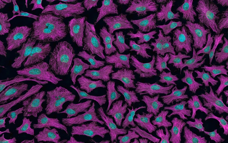Genre photo of pink/green cancer cells
