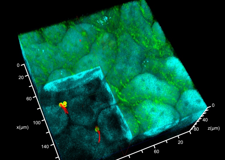 Reconstruction of an intravitally acquired z-stack of the renal cortex of a mouse 4 hours post infec