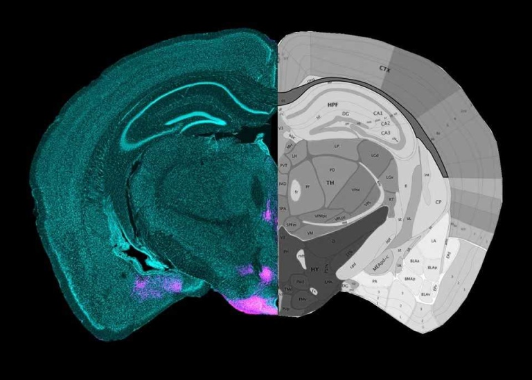 Image of mouse brain