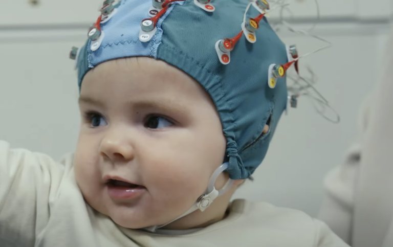 Bebis med mössa med elektroder som mäter hjärnvågor.